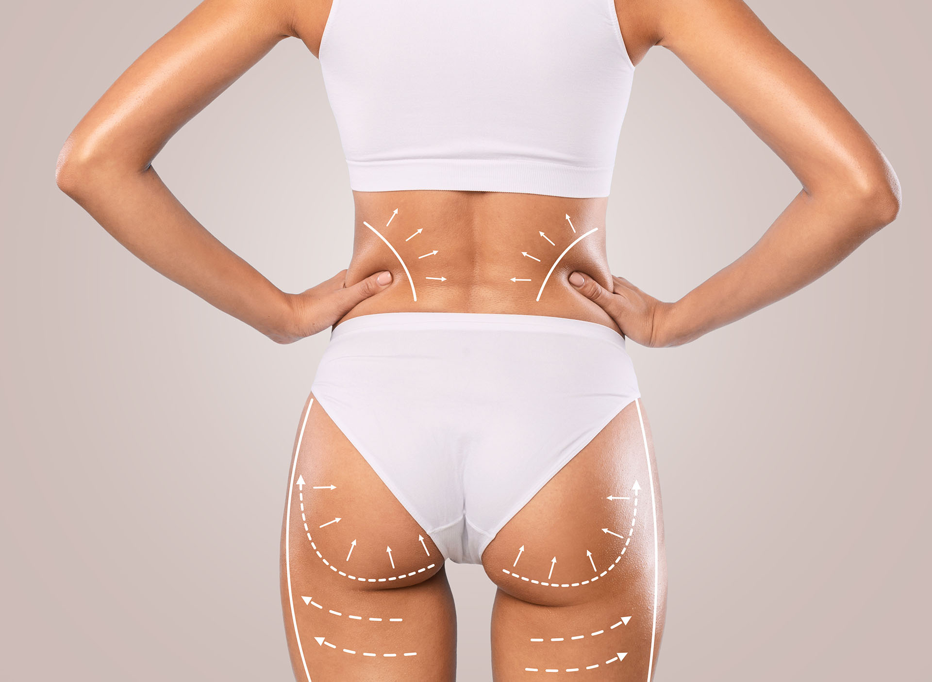 Body Lift Surgery Toronto