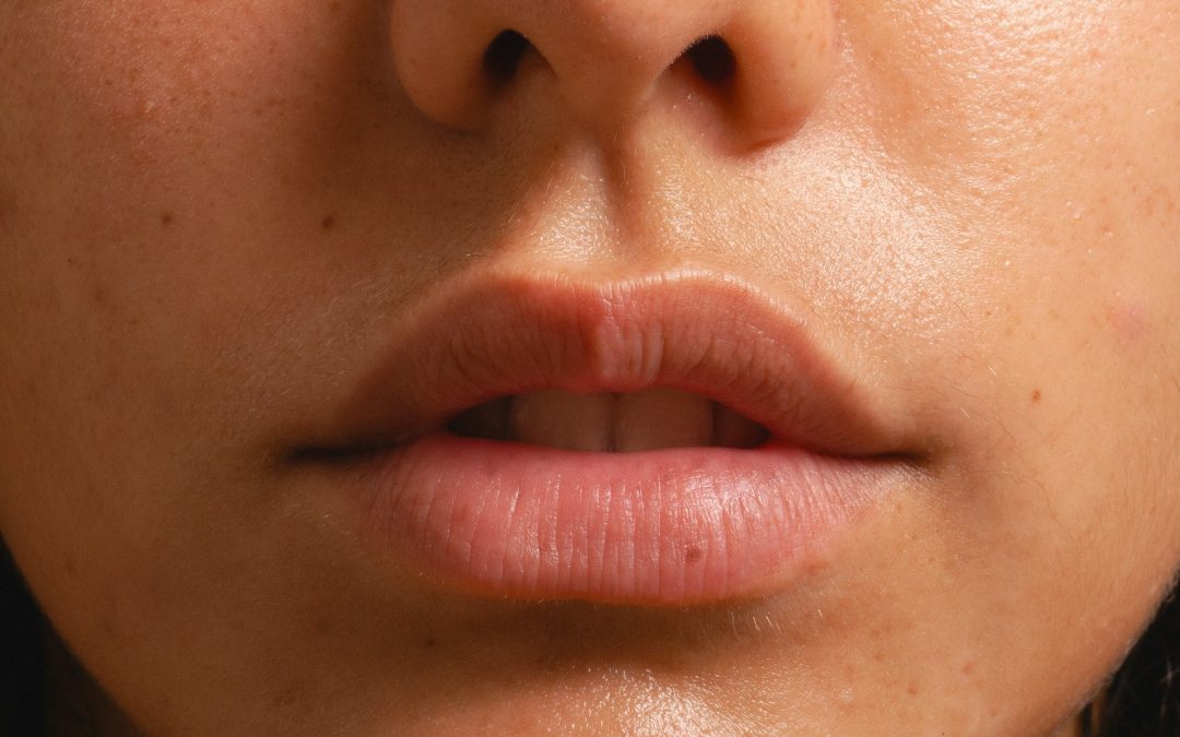 Your Guide to Lip Lift Surgery in Toronto What to Expect