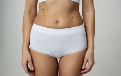 Spring Readiness With a Tummy Tuck in Toronto