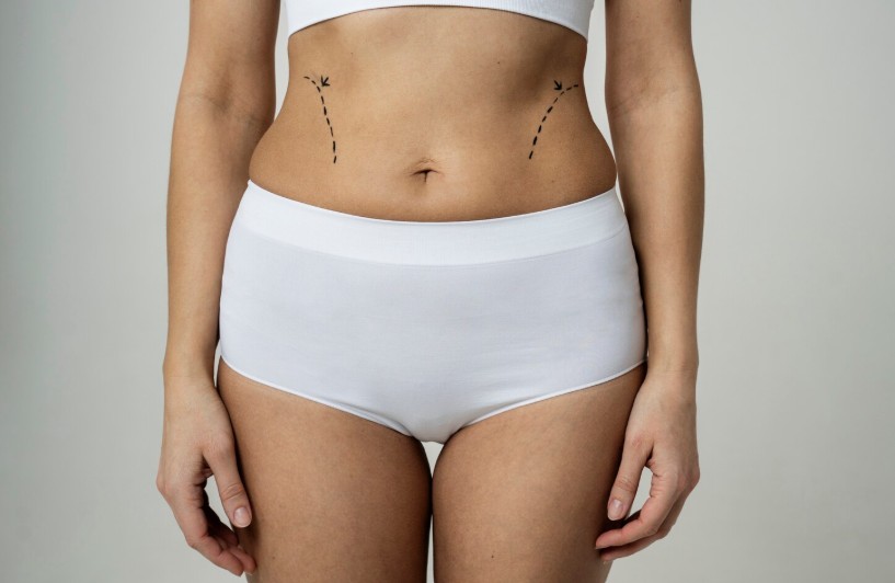Spring Readiness With a Tummy Tuck in Toronto