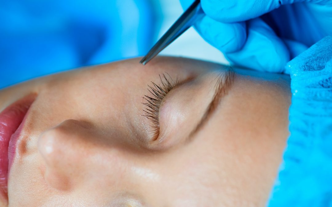 eyelid surgery