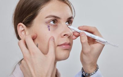 Eyelid Lift Surgery in Toronto: Upper vs. Lower Blepharoplasty