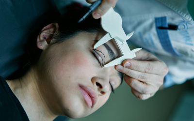 Eyelid Surgery in Toronto for Refreshed, Camera-Ready Eyes