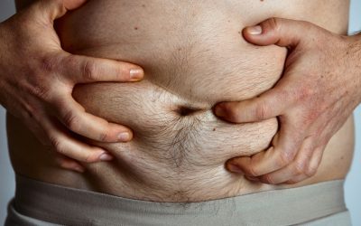 Recognizing When a Mini Tummy Tuck in Toronto Is Not Enough