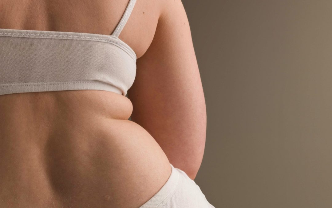Mistakes Toronto Liposuction Patients Make When Choosing a Clinic