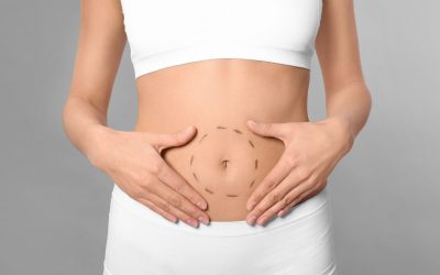 Choosing a Toronto Tummy Tuck Clinic for Discreet, Refined Results