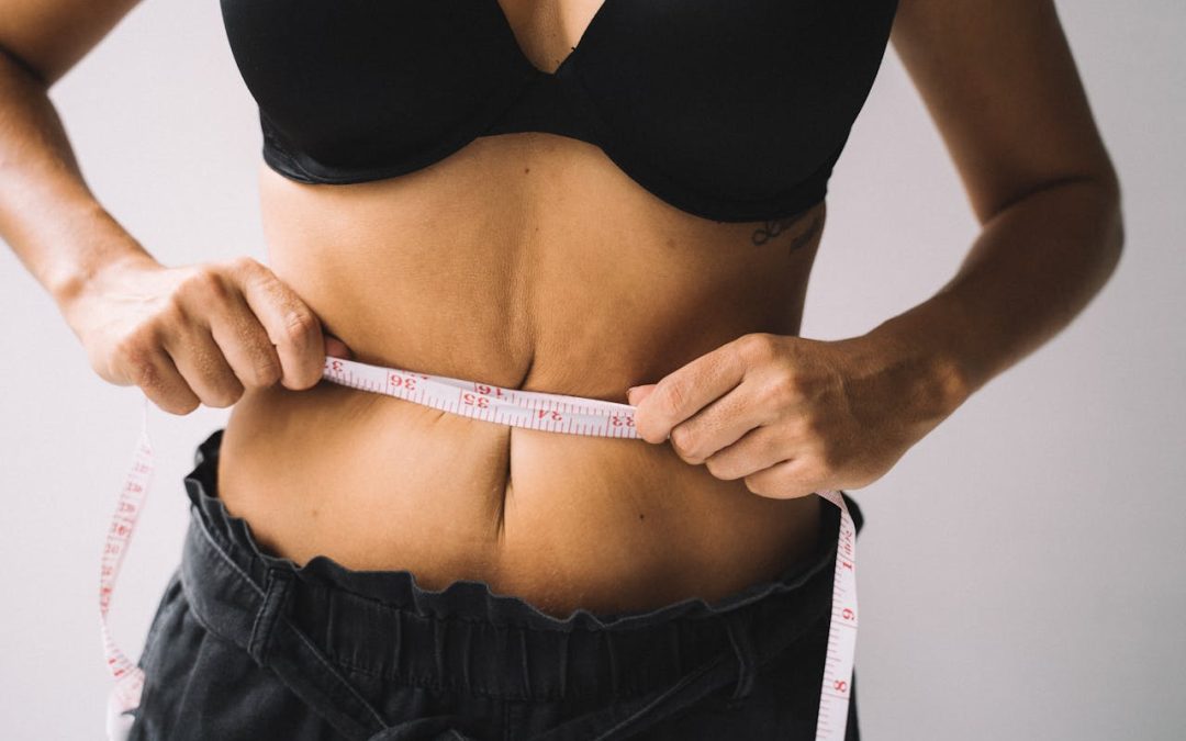 Mini Tummy Tuck Eligibility in Toronto: Is Your Laxity Above the Belly Button?