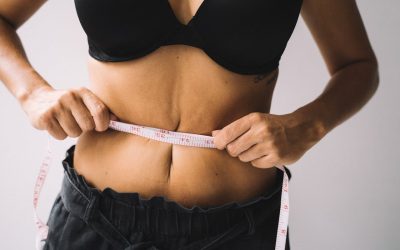 Mini Tummy Tuck Eligibility in Toronto: Is Your Laxity Above the Belly Button?