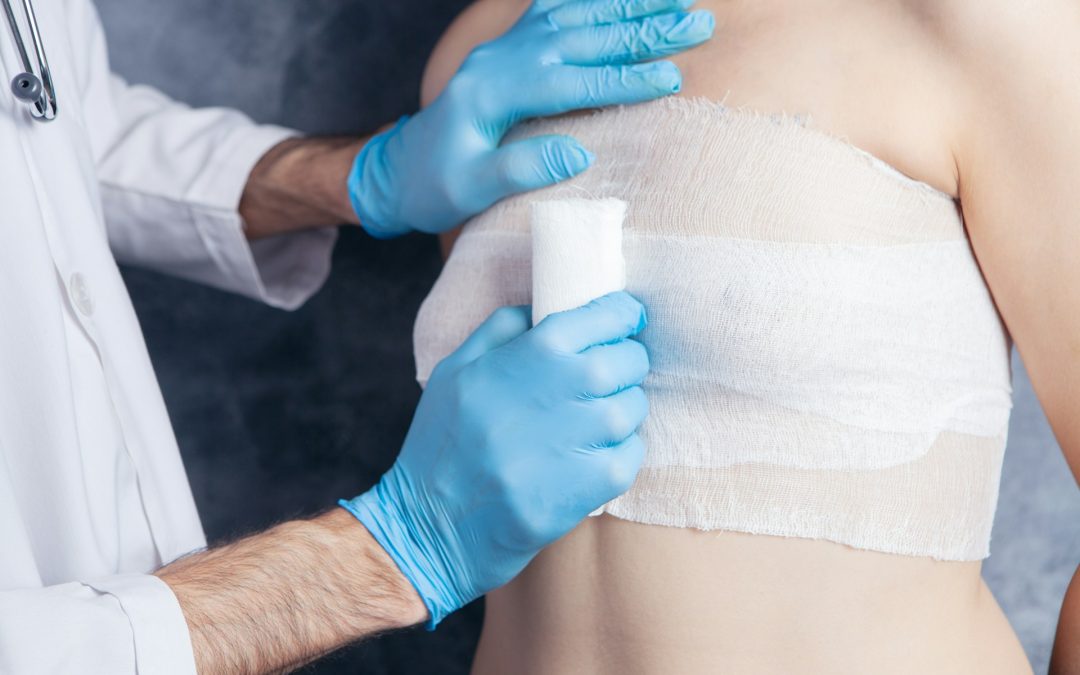 Common Toronto Breast Augmentation Mistakes to Avoid