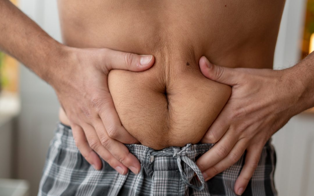 Evaluating Tummy Tuck Options in Toronto After Major Weight Loss