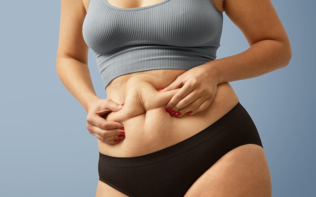 Discreet Toronto Tummy Tuck: Private Consults and Low-Visibility Recovery