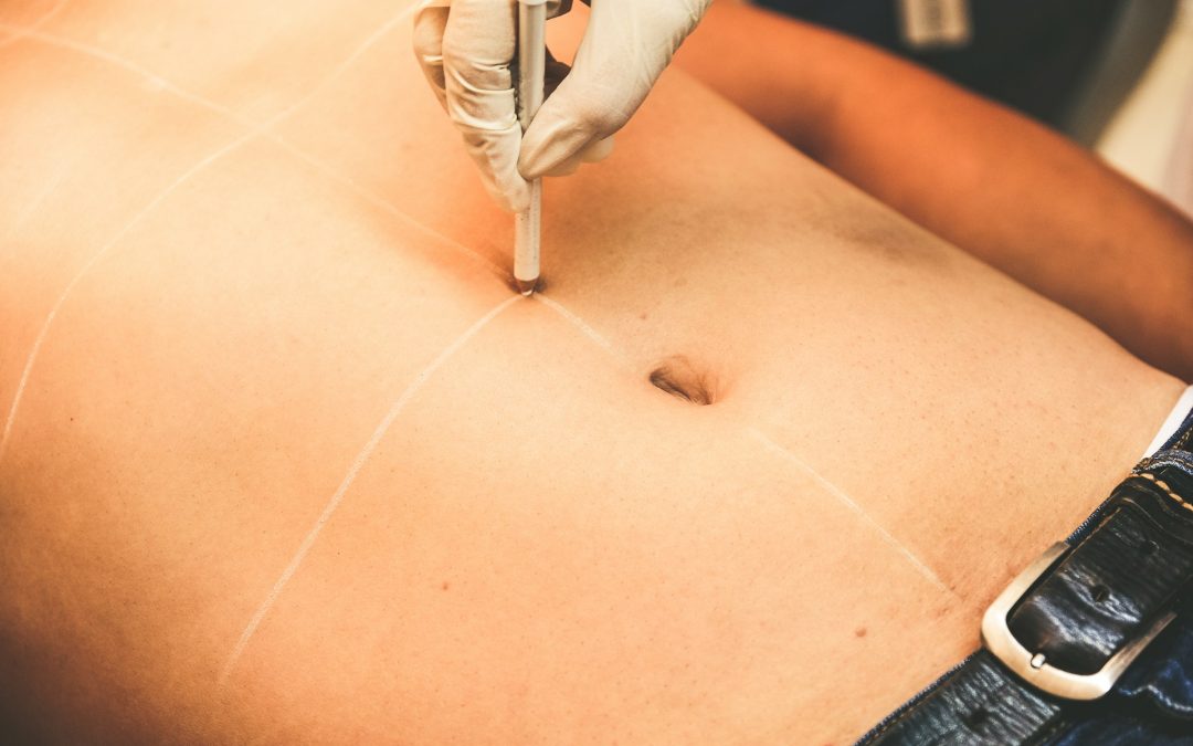 Evening Events and Tummy Tucks in Toronto: Planning Your Reveal