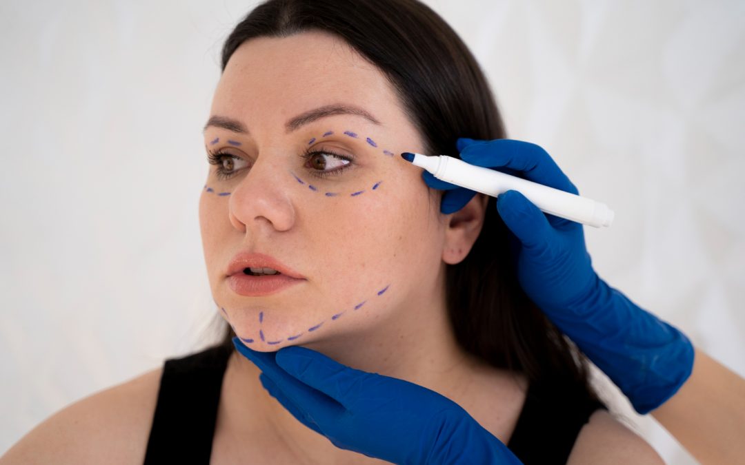 Mini Facelift Recovery in Toronto: Downtime, Swelling Timeline, Natural Results