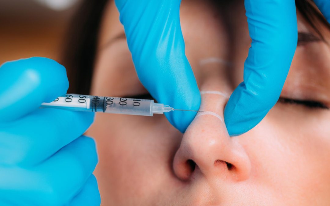 Nose Refinement in Toronto: Liquid Rhinoplasty (Filler) vs. Chin Augmentation